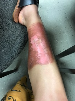 51674416659__658D46C9-6099-4244-9177-1F66896D6850